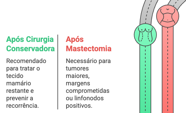 Fluxograma-indicacoes-radioterapia Critérios para radioterapia pós-cirúrgica em câncer de mama.