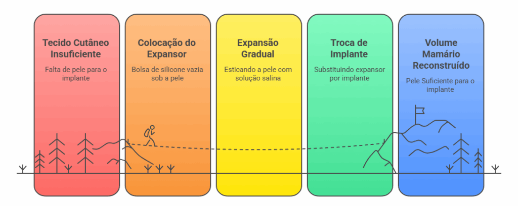Processo de reconstrução mamária com expansor de tecido: da colocação à troca por implante definitivo