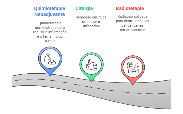 Sequência de tratamento multimodal para carcinoma inflamatório: quimioterapia neoadjuvante, cirurgia e radioterapia.