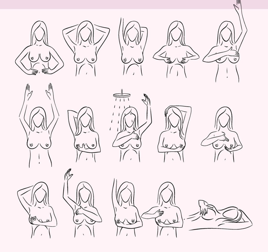 Infográfico vetorial colorido e detalhado que ilustra o passo a passo completo de como fazer o autoexame de mama em casa, mostrando as técnicas de palpação.