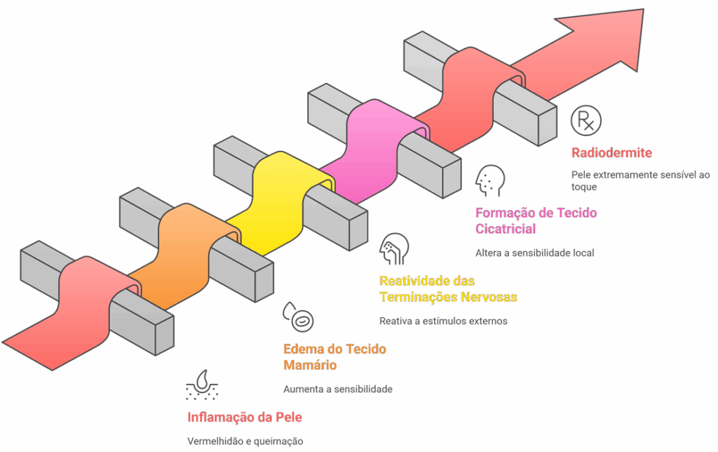 Fluxograma ilustrando as 5 causas da sensibilidade mamária após a radioterapia: radiodermite, formação de tecido cicatricial, reatividade das terminações nervosas, edema do tecido mamário e inflamação da pele.
